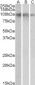 NTRK2 Antibody (internal region)